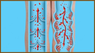 massage chair for knee pain Massage Chair for Knee Pain